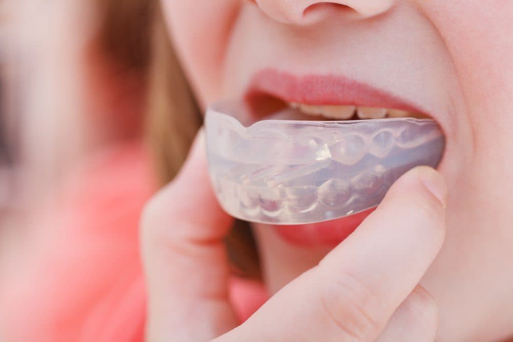 Nightguards and TMJ at Adelaide Dental, Downtown Toronto: What Are The Benefits of Nightguards For TMJ Nightguards and TMJ at Adelaide Dental, Downtown Toronto: What Are The Benefits of Nightguards For TMJ